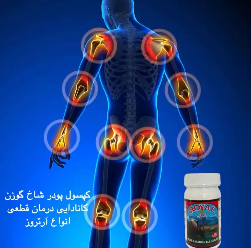 علت درد استخوان و کوفتگی بدن